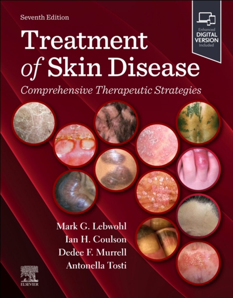 Treatment Of Skin Disease : Comprehensive Therapeutic Strategies/Product Detail/Healthcare