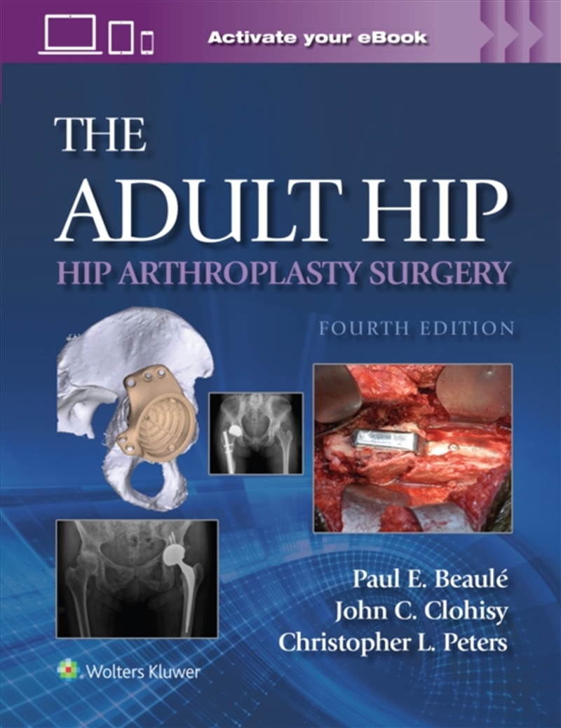 The Adult Hip: Hip Arthroplasty Surgery Print + Ebook With Multimedia/Product Detail/Healthcare