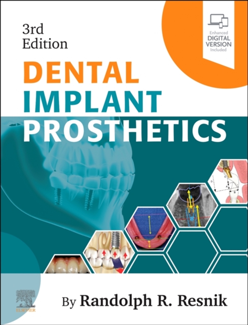 Dental Implant Prosthetics/Product Detail/Healthcare