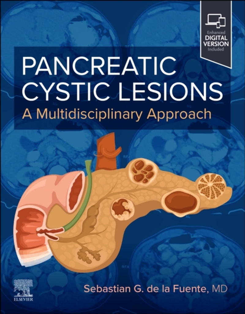 Pancreatic Cystic Lesions: A Multidisciplinary Approach : A Multidisciplinary Approach/Product Detail/Healthcare