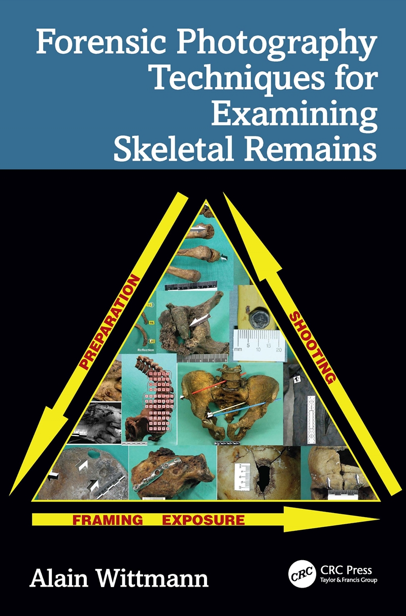 Forensic Photography Techniques for Examining Skeletal Remains/Product Detail/Society & Culture