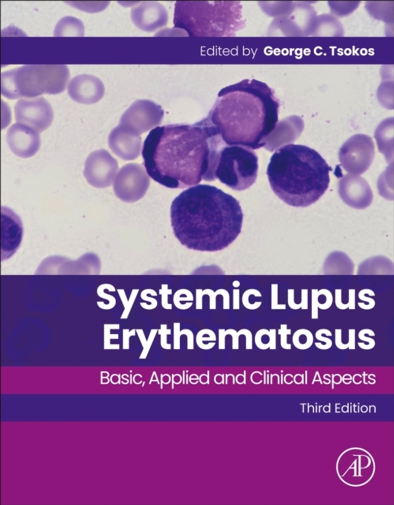Systemic Lupus Erythematosus : Basic, Applied and Clinical Aspects/Product Detail/Science