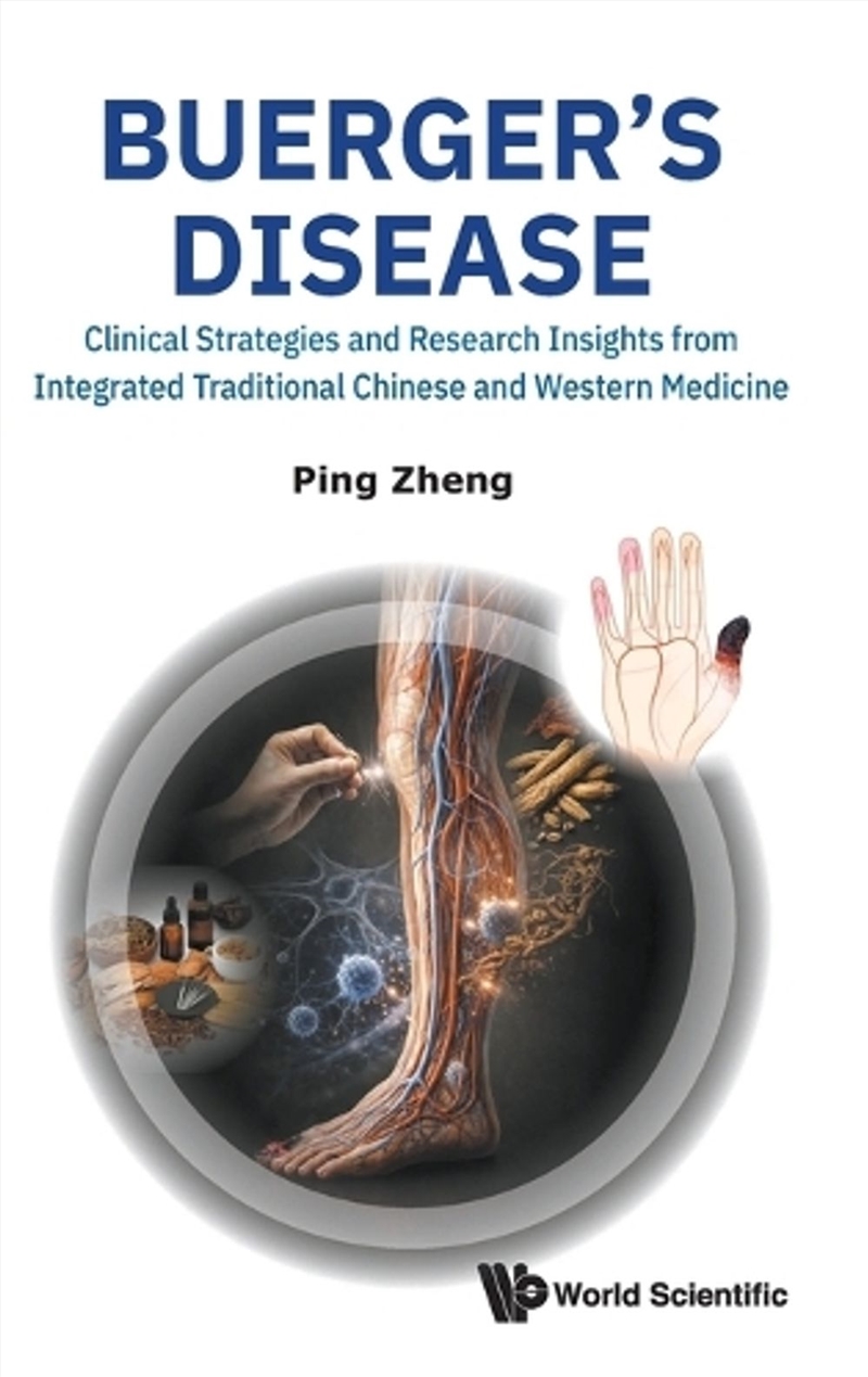 Buerger's Disease: Clinical Strategies And Research Insights From Integrated Traditional Chinese And/Product Detail/Science