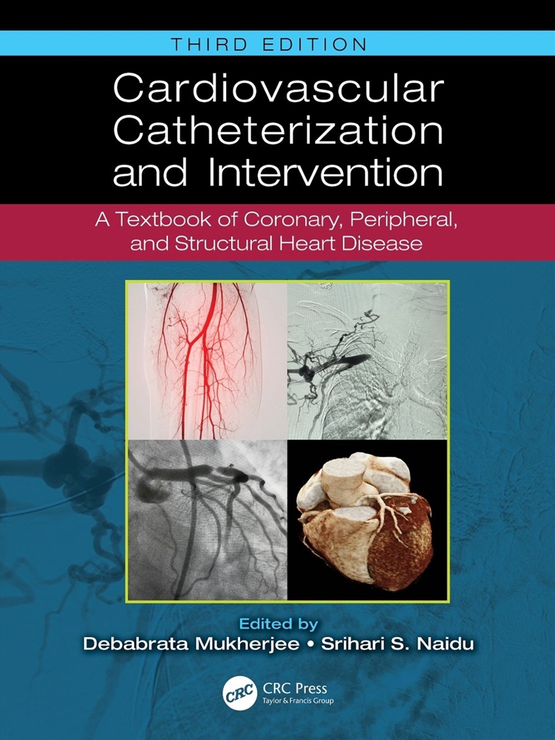 Cardiovascular Catheterization and Intervention/Product Detail/Healthcare