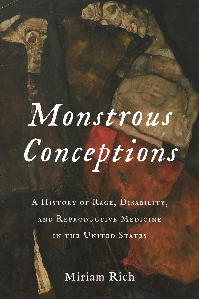 Monstrous Conceptions : A History of Race, Disability, and Reproductive Medicine in the United State/Product Detail/History