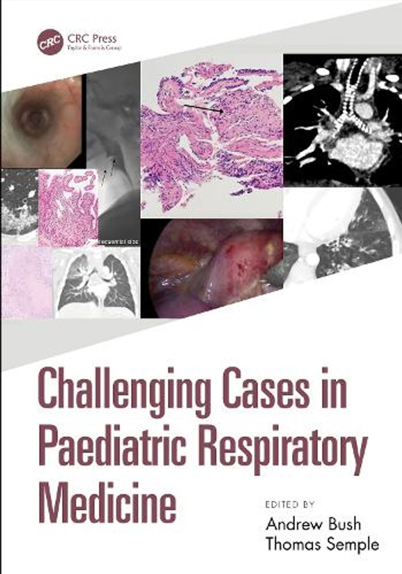Challenging Cases in Paediatric Respiratory Medicine/Product Detail/Healthcare