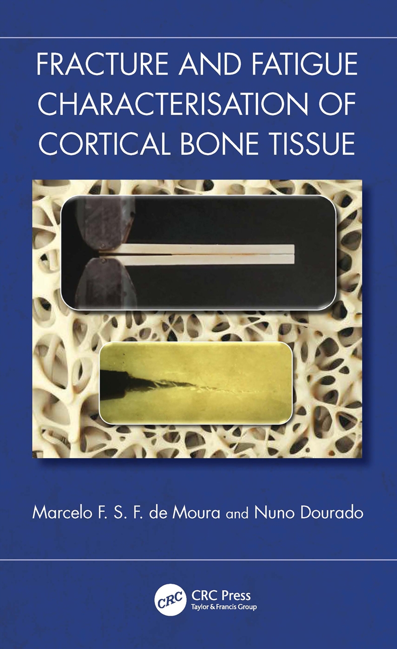 Fracture and Fatigue Characterisation of Cortical Bone Tissue/Product Detail/Science