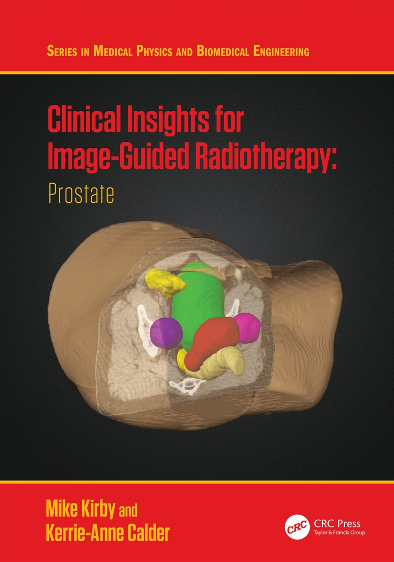 Clinical Insights for Image-Guidance Radiation Therapy/Product Detail/Science