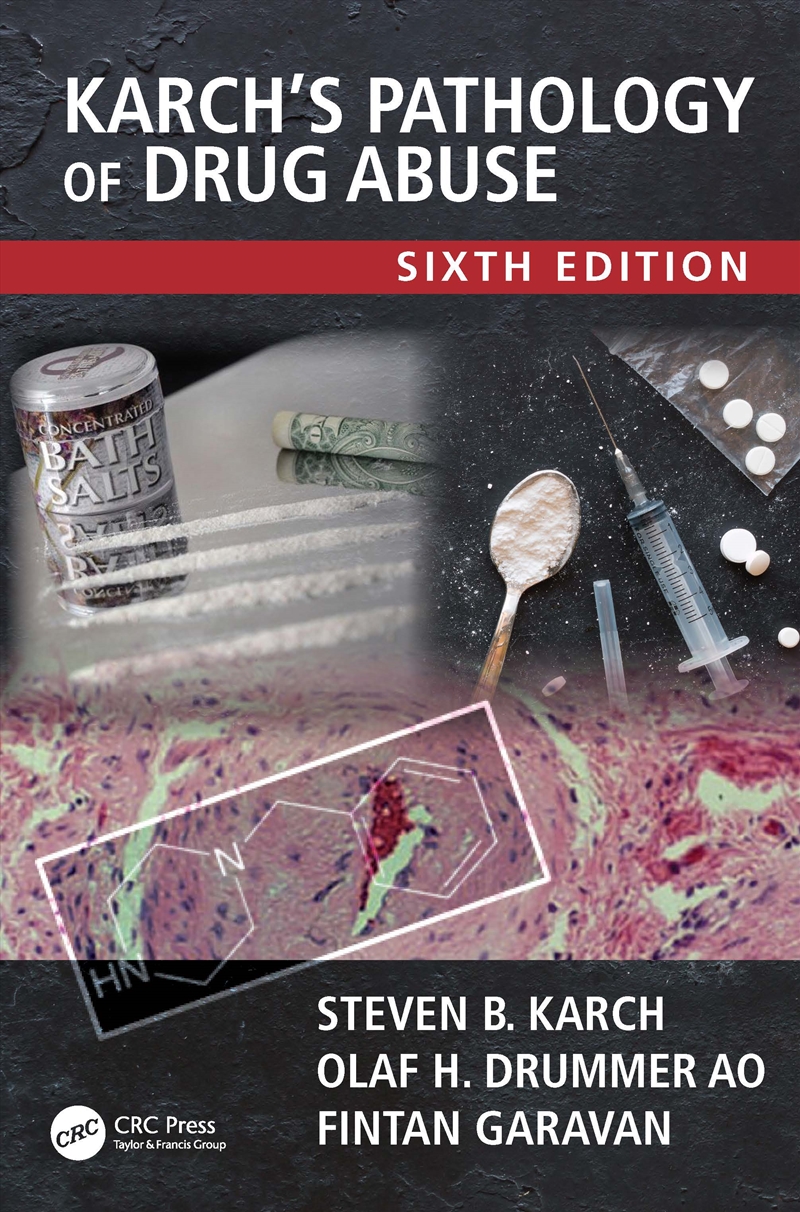 Karch's Pathology of Drug Abuse/Product Detail/Science