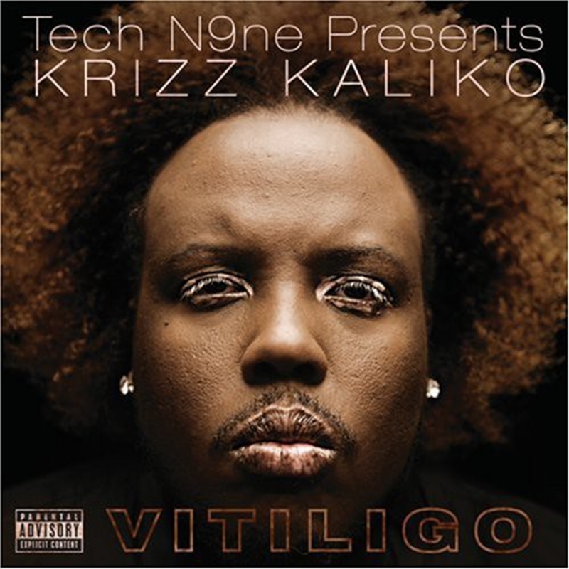 Vitiligo/Product Detail/Rap