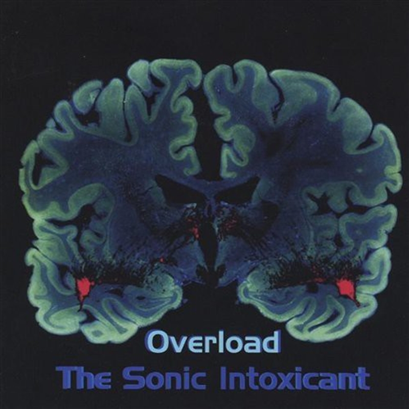 Overload: Sonic Intoxicant/Product Detail/Dance