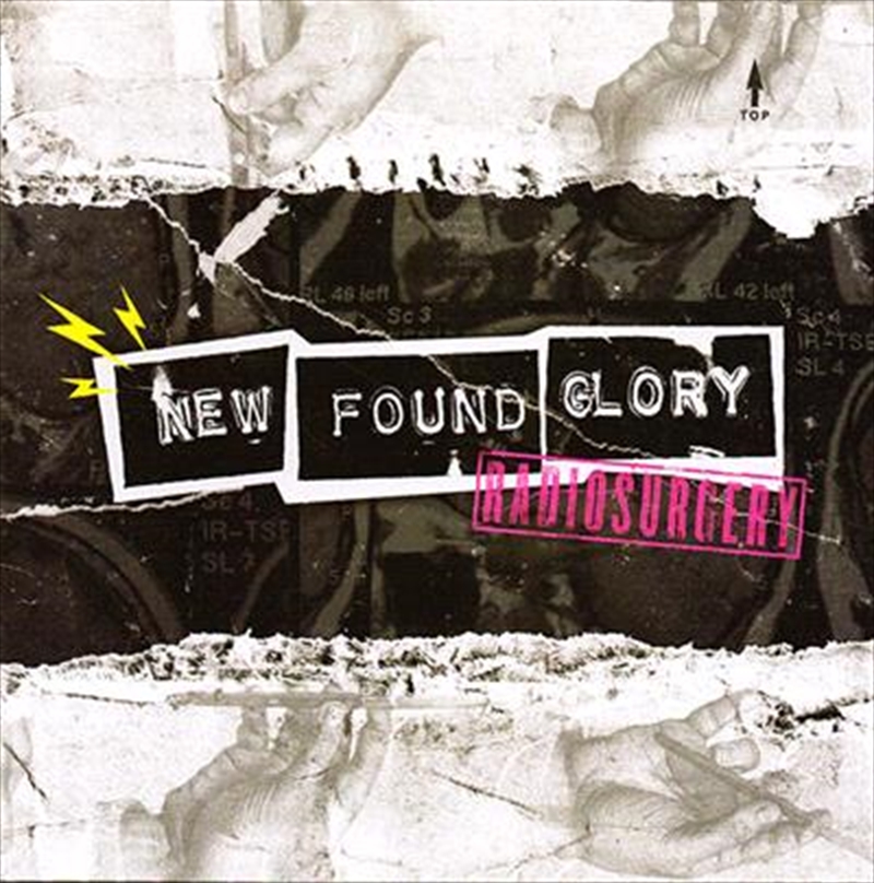 Radiosurgery/Product Detail/Punk