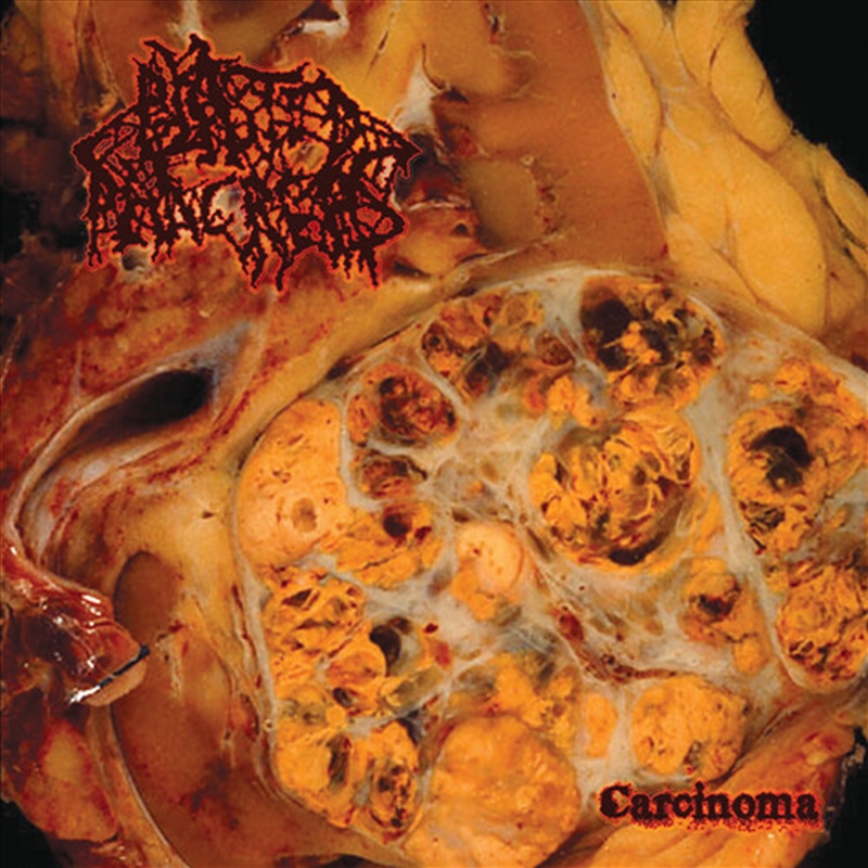 Carcinoma/Product Detail/Rock/Pop