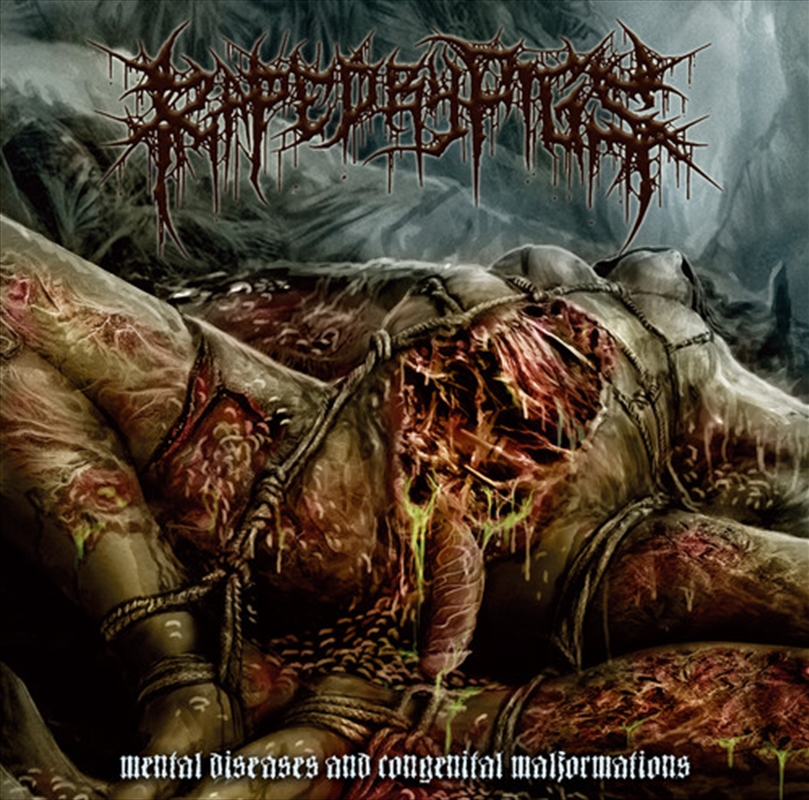 Mental Diseases And Congenital Malformation/Product Detail/Rock